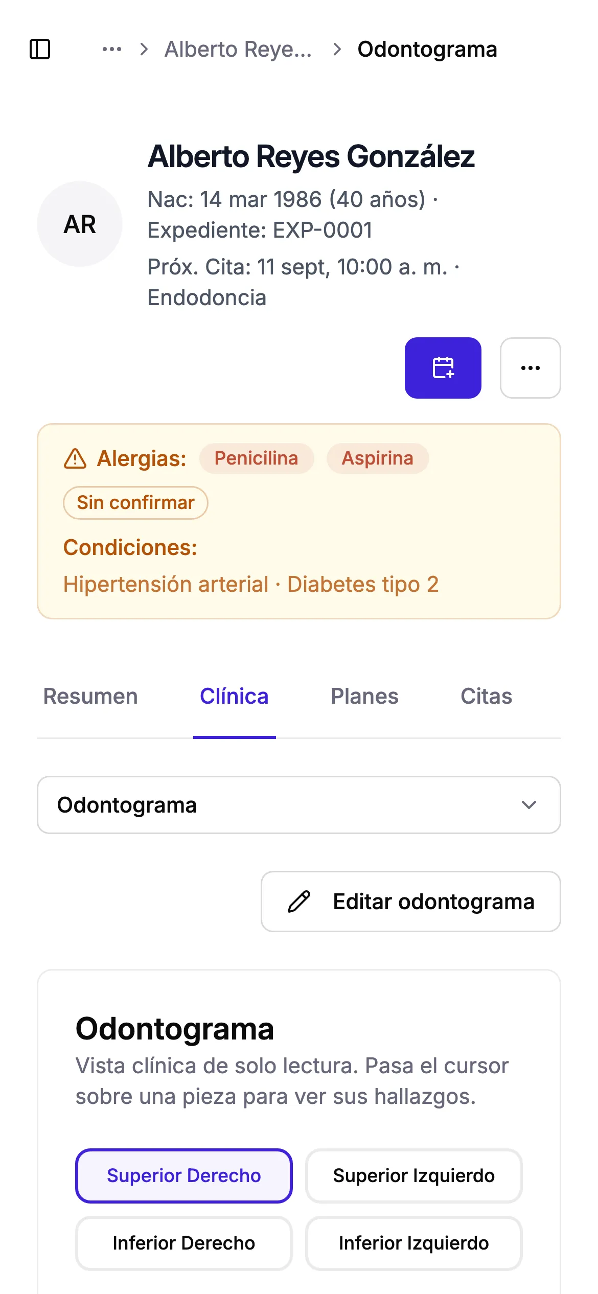 Odontograma de Revodent con los hallazgos de un paciente